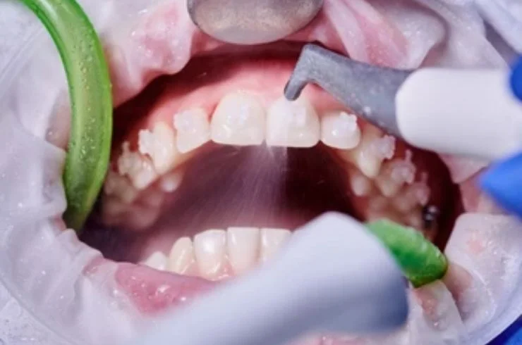 Oral Rehabilitations